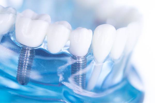 Maiores planos de odontologia para pequenas empresas