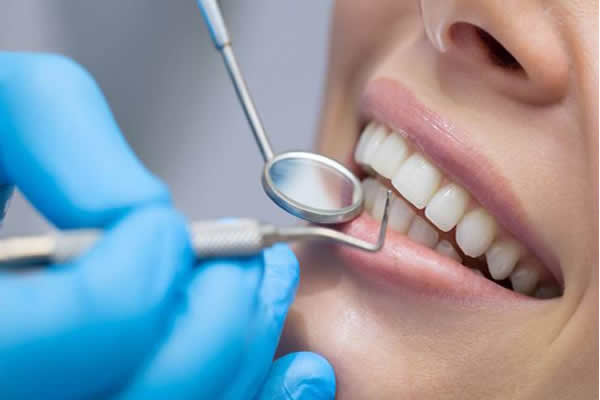 Como escolher o plano dental certo?